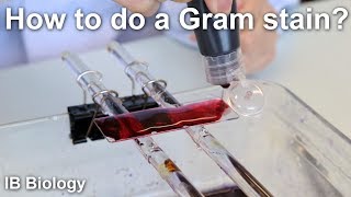 How to Do a Gram Stain? - Biology Lab Techniques