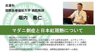 国際医療福祉大学熱海病院　オンライン健康講座「マダニ刺傷と日本紅斑熱について」　堀内義仁　皮膚科部長　病院教授（10分05秒）