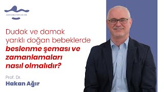 Dudak Damak Yarıklı doğan bebeklerde beslenme şeması ve zamanlamaları nasıl olmalıdır? -