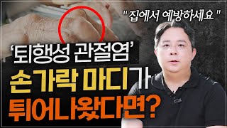 손가락 마디가 덜 튀어나와 보이게 하는 방법!!