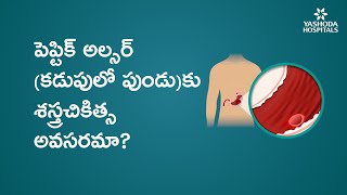 పెప్టిక్ అల్సర్‌ (కడుపులో పుండు)కు శస్త్రచికిత్స అవసరమా?