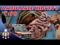 Surgeon Simulator [PS4] - Ambulance Kidney's Transplant (1:58) A Surgeon's Merit is Based on Speed