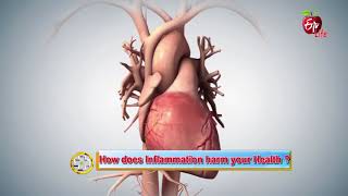 Aarogyamastu | Inflammations | 2nd January 2018  | ఆరోగ్యమస్తు