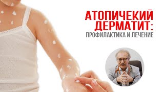 Атопический дерматит: профилактика и лечение