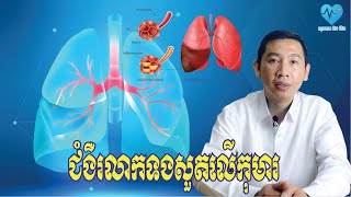 ជំងឺរលាកទងសួតលើកុមារ | bronchitis on children - សុខភាពនិងជីវិត​