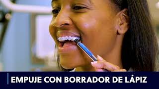 Spanish Foods NOT to Eat to Avoid Broken Braces (Espanol)