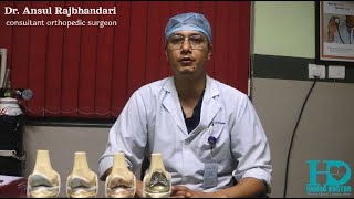 घोडाको जोर्नी  खिइएकोछ? जोर्नी प्रत्यारोपण किन छ यति महँगो ? Dr. Ansul Rajbhandari