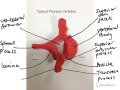 typical thoracic vertebra