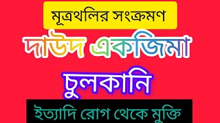 দাউদ, চুলকানি এবংক্যানডিডা জনিত মূত্রনালীর সংক্রমণ চিকিৎসায় নির্দেশিত Candinil  Fluconazole Capsule