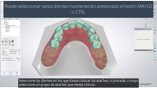 3Shape Clear Aligner Studio - Colocación automática de ataches - Automatic Attachment Placement