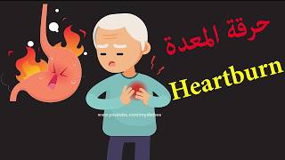 كيف تخلصت من حرقة المعدة في أقل من دقيقة  - Easy way to get ride of heartburn