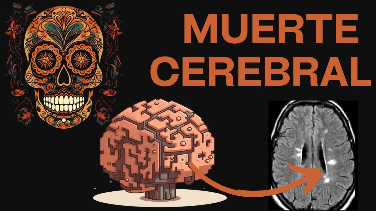 ¿Qué Es La Muerte Cerebral Y Cómo Se Detecta? - YouTube