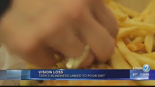 Scientists say poor diet made teen go blind