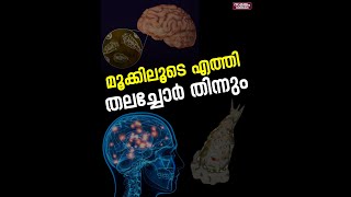 തലച്ചോര്‍ തിന്നും രോഗം |  Brain