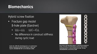 OrthoLine™ Fracture Management System: Biomechanics