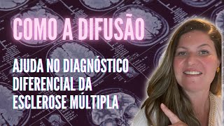 Use a difusão restrita como pista e faça a diferença entre esclerose múltipla e vasculite