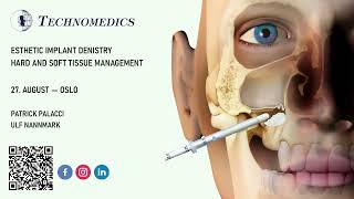 Esthetic Implant Dentistry – Hard and Soft tissue management