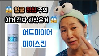 💣 얼굴들고 밖에 못나감 ㅜㅜ 기미/주근깨/검버섯 없앤다고.. 어드마이어 마이스킨(admire my skin)이거 실화임.정말 괜찮은가(4-5일차 경험)