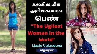 உலகின் மிக அசிங்கமான பெண் | The Ugliest Woman in the World | Lizzie Velasquez | Mithappugal | Ravi