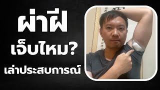 ผ่าฝี ผ่าตัด เจ็บไหม? - เล่าประสบการณ์