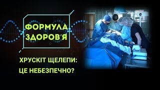 Хрускіт щелепи: просто звук чи небезпечний симптом? - Формула здоров'я