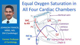 Equal Oxygen Saturation in All Four Cardiac Chambers