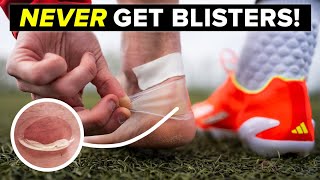 How to NEVER get blisters again from your football boots!