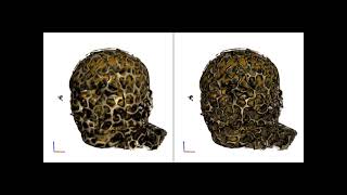 Texture Transfer Functions for Direct Volume Rendering