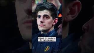 Did a bloody eye stop Thibaut Courtois?