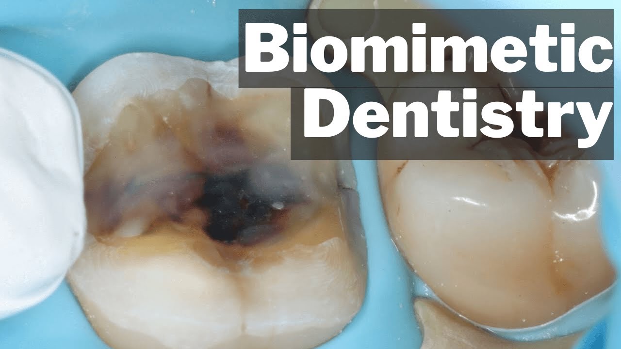 Biomimetic Dentistry - What Actually Is It? - PDP135 - YouTube