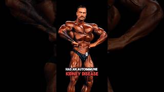 Chris Bumstead Kidney Disease