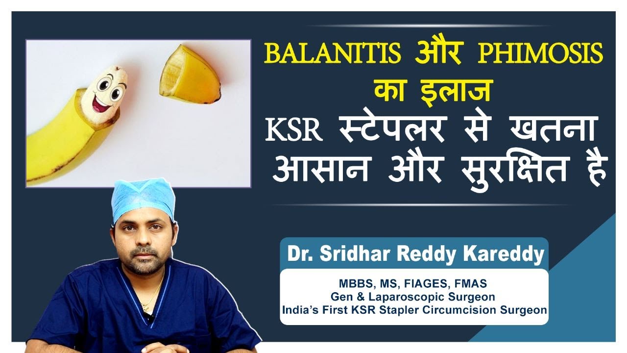 Ksr Stapler Circumcision Best Circumcision Specialist In India
