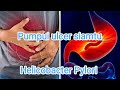 H. PYLORI - Pumpui ulcer siamtu (@Gilead-Thinghnai)