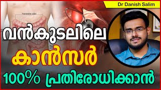 725: വന്‍കുടലിലെ കാൻസർ 100% പ്രതിരോധിക്കാൻ..100% prevention of Colon Cancer