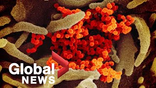 Coronavirus outbreak: 7 confirmed cases of COVID-19 in Alberta | FULL
