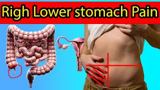 Right Lower Abdominal Pain,  7 Causes You Need to Know!