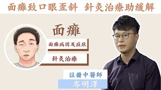 面癱致口眼歪斜 針灸治療助緩解