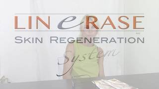 Linerase Skin Regeneration System -  Polish Patient