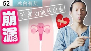 #52艾灸养生 女人功能性子宫出血（崩漏）有什么办法？ 艾灸让女人摆脱妇科病。Moxibustion for the treatment of uterine bleeding