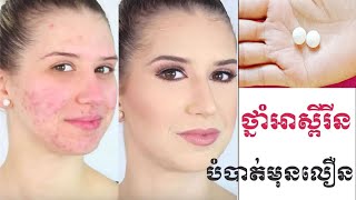 How To Treat Acne Using Aspirin | វិធីបំបាត់មុនត្រឹមតែ១យប់ | Acne \u0026 Pimples Acne Treatment Overnight