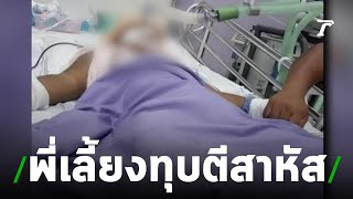 หวังปาฏิหาริย์! ด.ช.2ขวบเหยื่อพี่เลี้ยงโหด | 25-07-62 | ไทยรัฐนิวส์โชว์