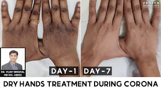 Dry Hands/ फटे, सूखे हाथ कैसे घर पे ठीक करें