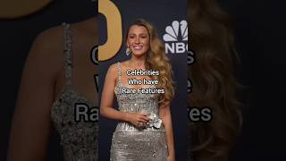 No way these Celebs have these Rare Features #CelebRatings #RateYourFaves #CelebReviews