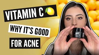 How Vitamin C Helps with Acne and Acne Scars