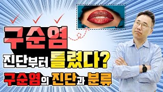 💥구순염은 안 낫는 이유는 진단과 분류가 틀려서 입니다👉구순염의 정확한 진단과 분류👈