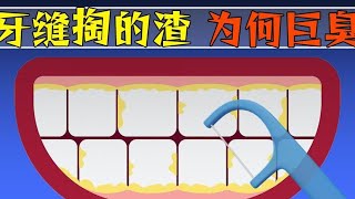 牙缝掏出来的渣渣到底是什么，为什么这么臭？【科普小姐姐】