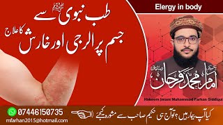 Elergy In Body...جسم پر الرجی اور خارش کا علاج۔۔۔