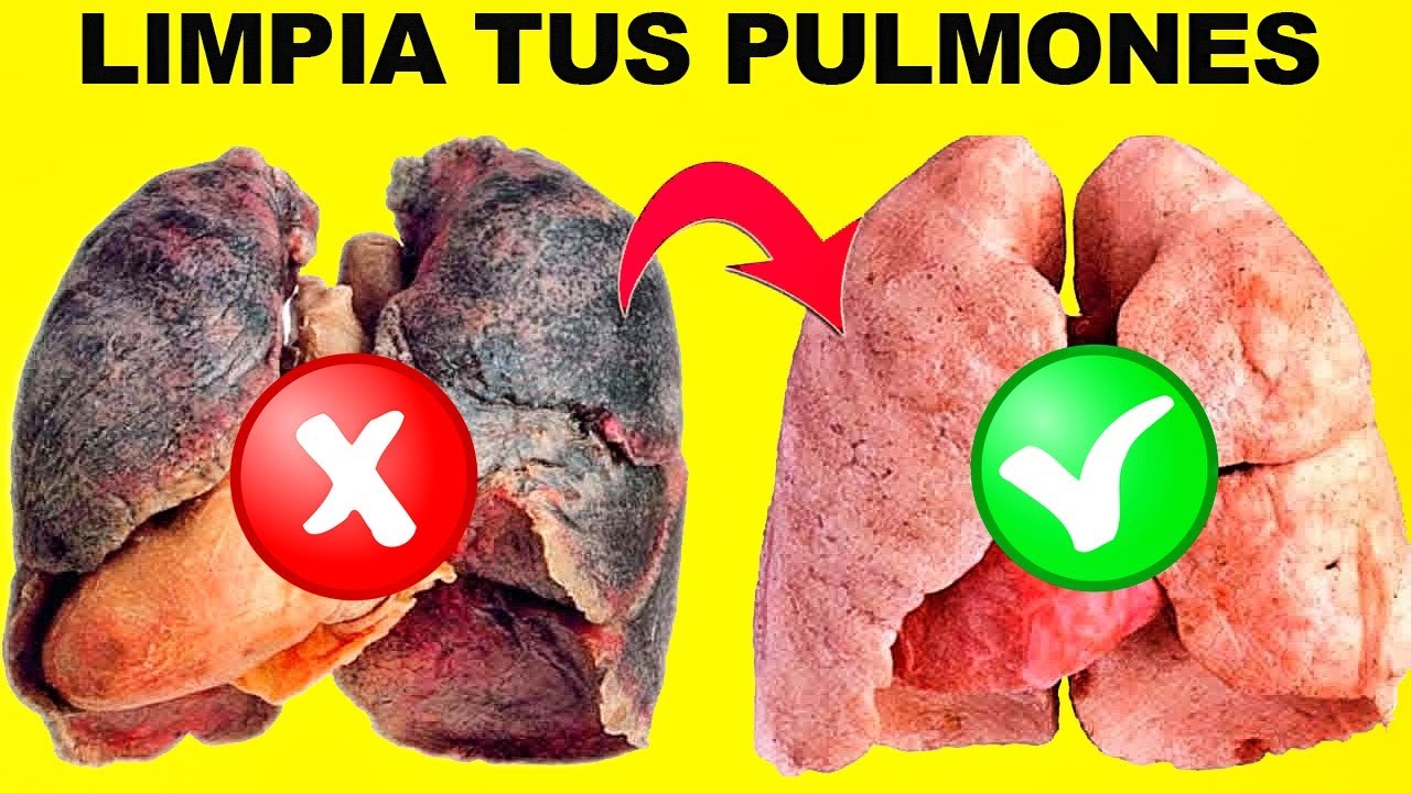 3 Plantas Que Puedes Preparar Para Limpiar Y Purificar Tus Pulmones ...