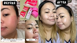 Rosmar Kagayaku Rejuvenating Kit Review | Effective or Hype Lang?