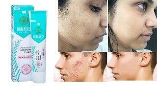 *New *Bajaj Nomarks Cream For Normal Combination Oily Skin Review Uses Benefits | Side Effects